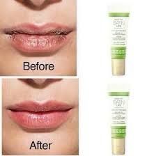 Are your lips dry? How about fine lines?
